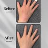 Eczema Powder