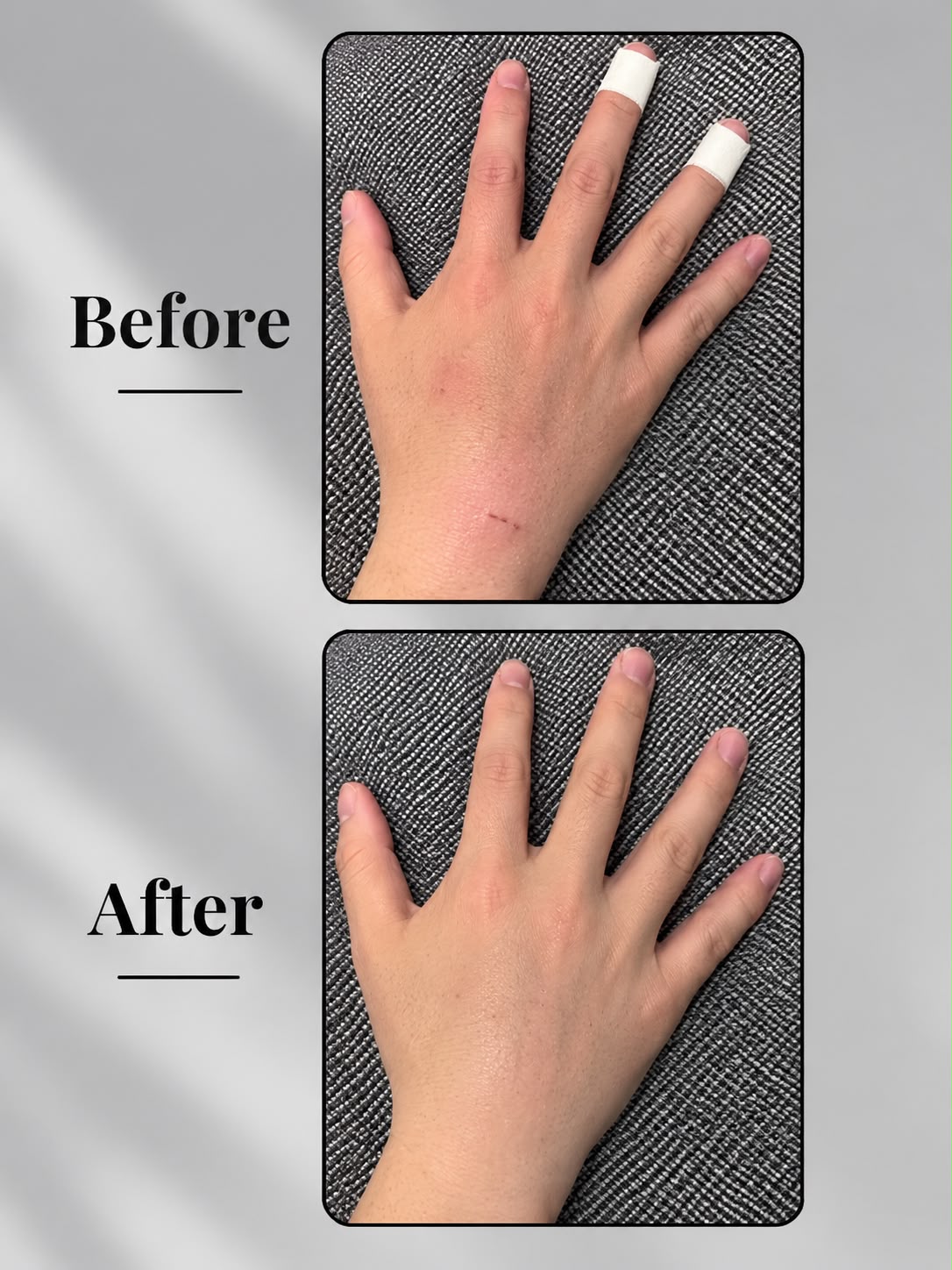 Eczema Powder