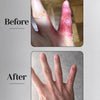 Eczema Powder