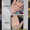 Eczema Powder